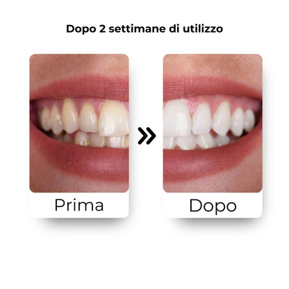 Oralvibes® I L'evoluzione dell'igiene dentale